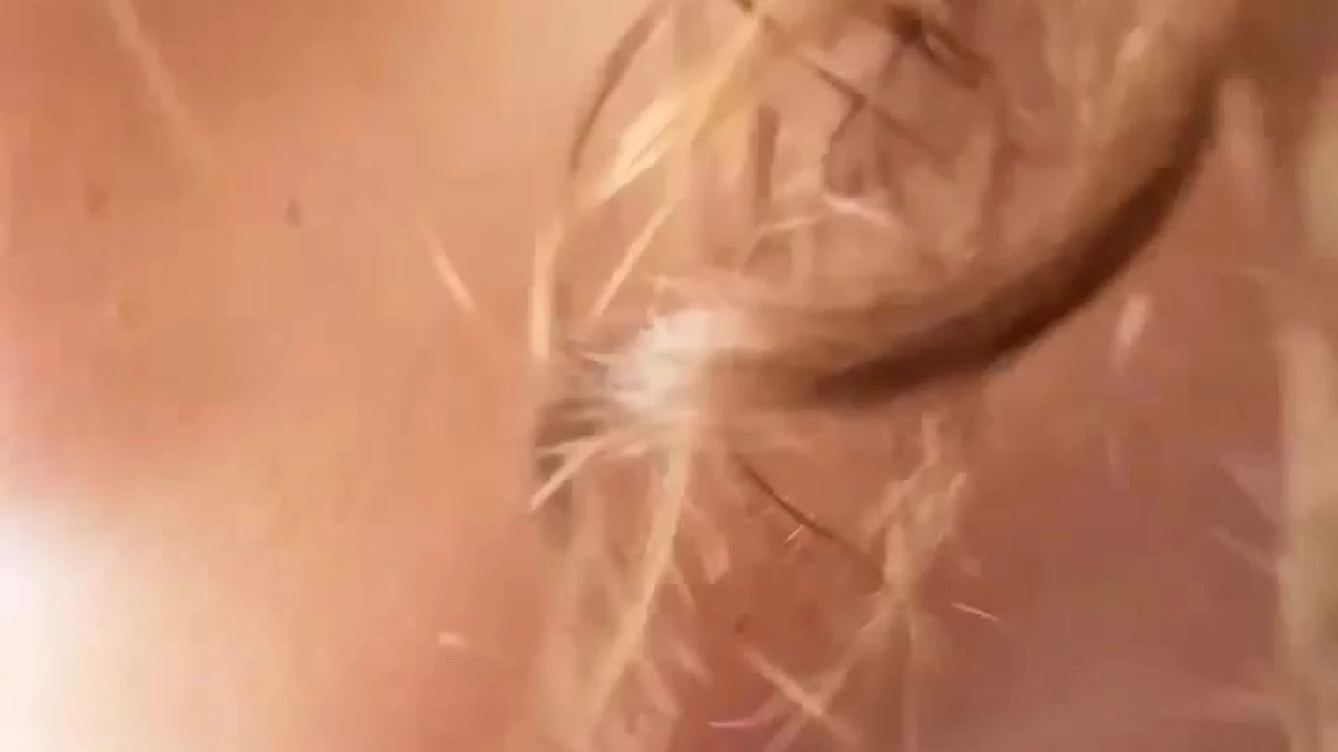 abrasive sucking sexy titties LupuWellness sex