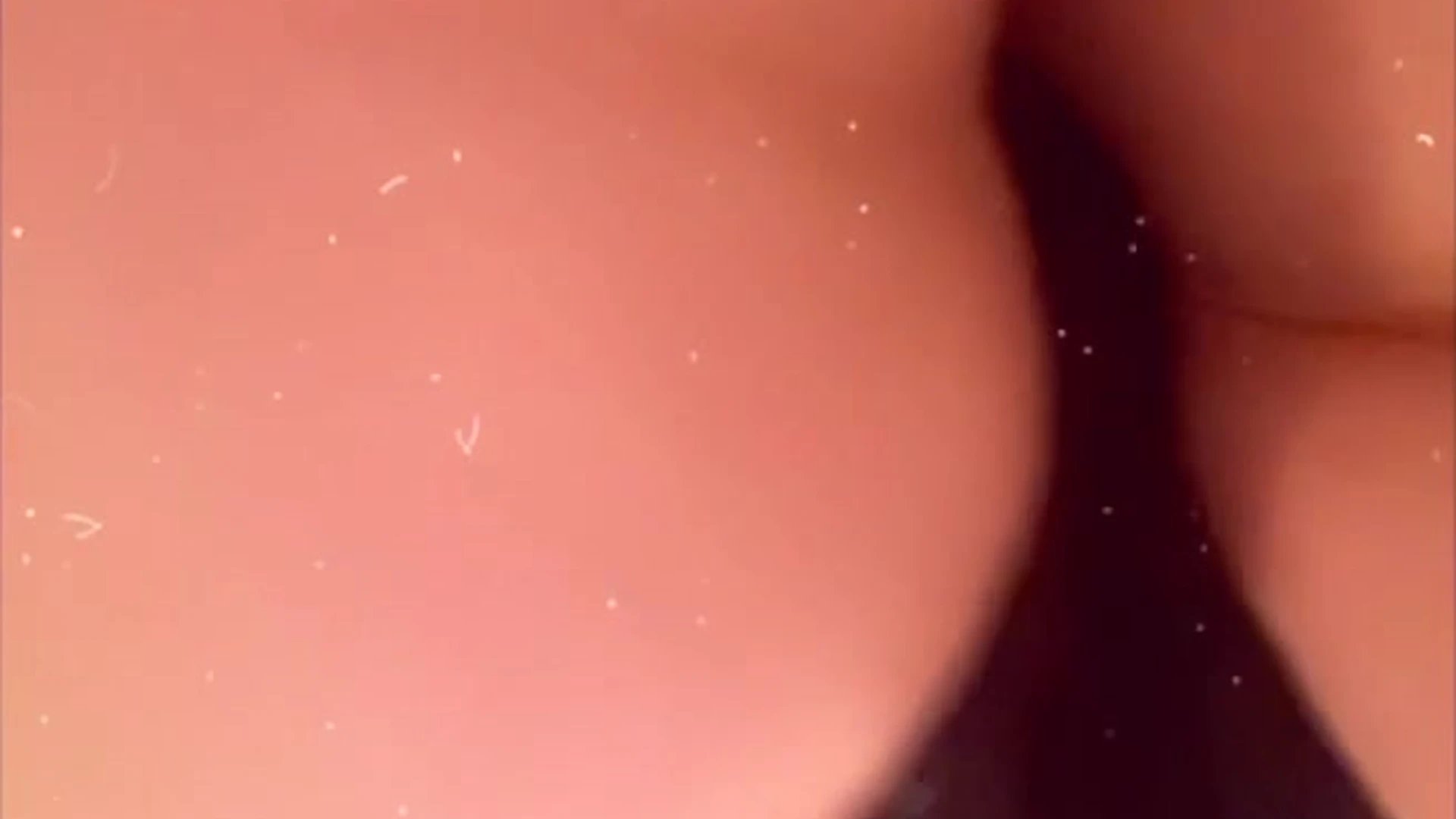 cure Kit Mercer pussy Exposed